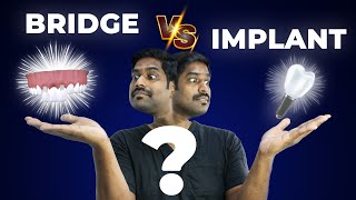 பல் கட்டுவதில் எது சிறந்த முறை   Dental Bridge Vs Dental Impant  Denta Kings [upl. by Kciredorb]