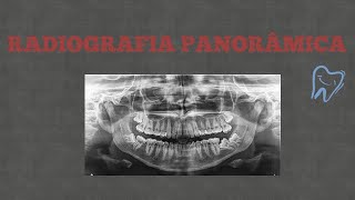 RADIOGRAFIA PANORÂMICA  PASSO A PASSO [upl. by Phaidra]