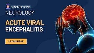 ACUTE ENCEPHALITIS SYNDROME  ACUTE VIRAL ENCEPHALITIS [upl. by Pinette]