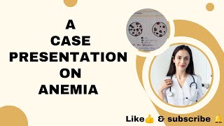 case presentation on ANEMIA casepresentation careplan nursingcareplan assignment anemia [upl. by Htebirol]