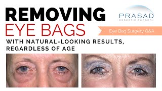 NaturalLooking Eye Bag Removal Surgery at Any Age  Not Removing Eyelid Skin is Key [upl. by Sinnaiy]