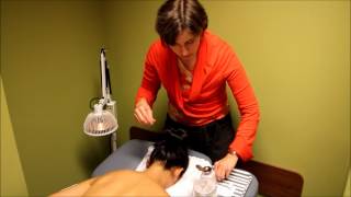 Acupuncture Demonstration and Benefits [upl. by Nellac140]