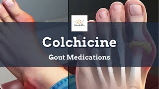 colchicine  Uses Dosage Side Effects amp Mechanism  Colcrys [upl. by Pogah]