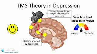 Transcranial Magnetic Stimulation A New Treatment Approach for Psychiatric Disorders [upl. by Ahsemac]