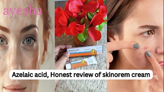 How to Use Azelaic Acid 20 benefits of azelaic acid Skinoren Cream Review in Pakistan [upl. by Noed641]