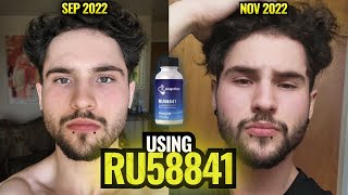 How To Actually Use RU58841 For Hair Loss [upl. by Olumor]