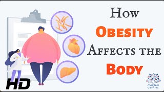 The Heavy Burden of Obesity Understanding its Effects on Your Body [upl. by Arianne]