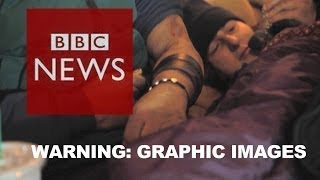 BBC goes undercover inside Americas heroin epidemic  BBC News [upl. by Iorgo385]