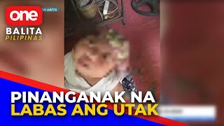 Anencephalic baby nabuhay lang sa loob ng 24 araw [upl. by Melamie]