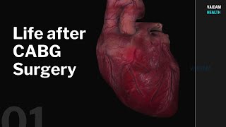 Life after CABG Surgery [upl. by Vachil]