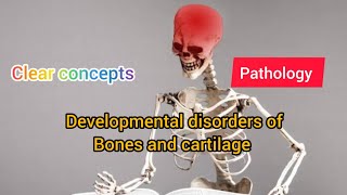 Developmental Disorders of Bone and Cartilage Part I  Pathology  MAT MEDICOS [upl. by Freda202]