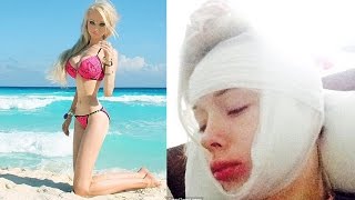 Human Barbie Assaulted Outside Her House [upl. by Patton331]