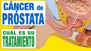 Cáncer de Próstata  Tratamiento [upl. by Ayanahs]