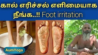 கால் எரிச்சல் உடனடியாக குணமாக  Foot irritation  kal earichal  kal viral erichal treatment in tami [upl. by Kingsley50]