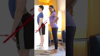 Correct anterior pelvic tilt with this  Anterior pelvic tilt exercises  Dr Dhwani Jain [upl. by Hodess]