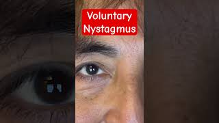 Voluntary Nystagmus Shorts [upl. by Shelman]