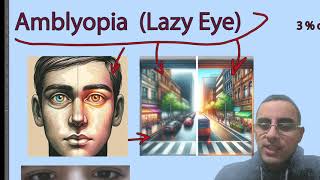 Lazy Eye Amblyopia  Causes and Treatment in kids and adults [upl. by Sura]