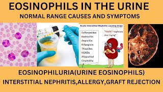 EOSINOPHILS IN URINENORMAL RANGE CAUSES OF EOSINOPHILS IN URINELYMPHOCYTES MONOCYTES IN URINE [upl. by Aldis]