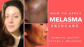 How to apply Melasma treatment creams  Nipun Kapur [upl. by Haim]