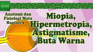 Miopia Hipermetropia Astigmatisme dan Buta Warna  Bagian 3 [upl. by Odraboel]