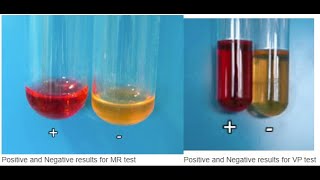 Methyl readVoguesProskauer MRVP [upl. by Ralston]