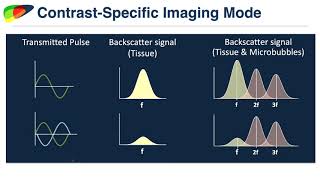 27 Contrast Enhanced Ultrasound of the Liver  Part 1 By Dr David Fetzer [upl. by Latsyrhc747]