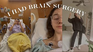 My Brain Surgery Story  Pituitary Tumor Removal [upl. by Bolme]