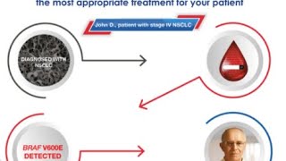 Guardant360’s Comprehensive Genotyping in NSCLC [upl. by Nossyla]