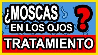 Moscas Volantes en los ojos Tratamiento  3 simples pasos [upl. by Any]