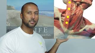 Release Sternocleidomastoid Trigger Points [upl. by Ylatan73]