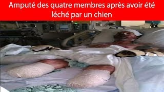 Amputé des quatre membres après avoir été léché par un chien [upl. by Jotham138]