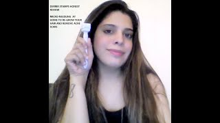 DERMA STAMPYAY OR NAY nonsponsoredreview honestreview hairgrowth microneedling skincare [upl. by Ylsel403]