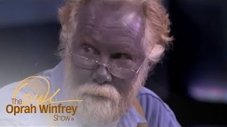 A Look Back at the Man Who Turned Blue  The Oprah Winfrey Show  Oprah Winfrey Network [upl. by Orihakat]