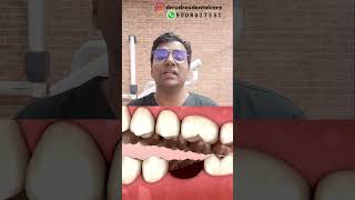 Dr Rudra Why is it necessary to replace lost teeth ASAPmissingteeth teethreplacement dentistry [upl. by Sinnaoi651]