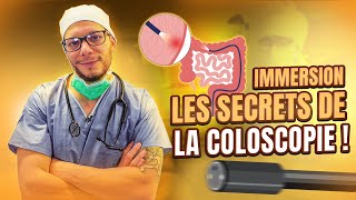 La coloscopie ce que vous navez jamais vu [upl. by Jillie882]