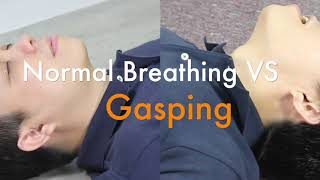 Sudden Cardiac Arrest SCA and Agonal Breathing Gasping [upl. by Jowett]