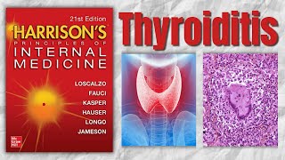 THYROIDITIS  Classification  Causes  Clinical Features  Treatment  Harrision [upl. by Witcher]