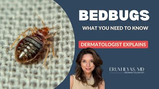 Bed Bugs  What you need to know [upl. by Kerwon]