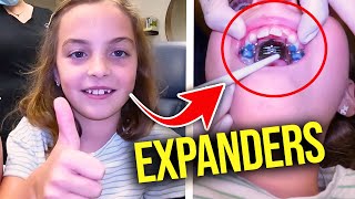 Getting a Palatal ExpanderHow expanders work  McKinney Orthodontist [upl. by Noelc]