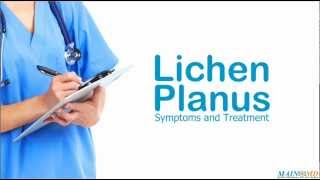 Lichen Planus Symptoms and Treatment [upl. by Meneau544]