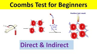 Coombs Test Principle Types Procedure Interpretation  Coombs test Direct and Indirect [upl. by Navert]