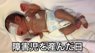 【障害児出産】障害を持つ子供を育てるってどんな感じ？想像できる？指定難病 [upl. by Haslett]