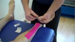 How to apply Kinesiology Taping for Tibialis Anterior Tendonopathy Anterior shin splints [upl. by Alper73]