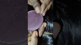 ASMR checking lice and nits😱😱😱😱😱 Oooooooo lots of big bigbig lice [upl. by Cranston432]