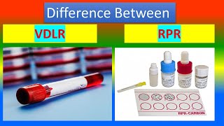 Difference between venereal disease research laboratory VDRL and Rapid Plasma Reagin RPR [upl. by Rask]