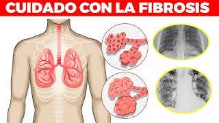 SEÑALES DE ALARMA de que tienes fibrosis pulmonar como vivir con ella y tratamiento [upl. by Oskar]