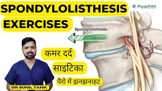 Spondylolisthesis Exercises  Spondylolisthesis physiotherapy treatment  L4L5 L5S1  Sciatica [upl. by Elyn]