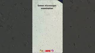 semen microscopic examination labtechnicianvacancy group5exam [upl. by Asilram]