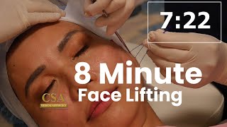 8Minute Face Lifting using COG threads [upl. by Proctor]