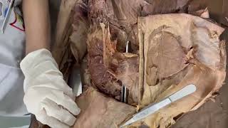 DEMONSTRATION OF INGUINAL CANAL [upl. by Yelrah]